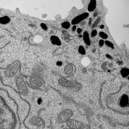 Melanogenesis