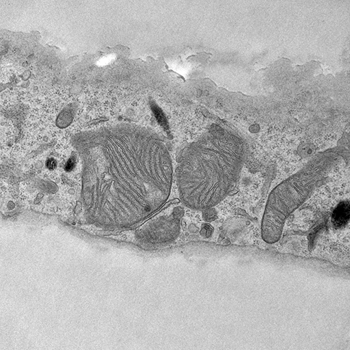 Organelle